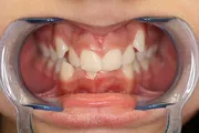 Orthodontics_Before1.jpg